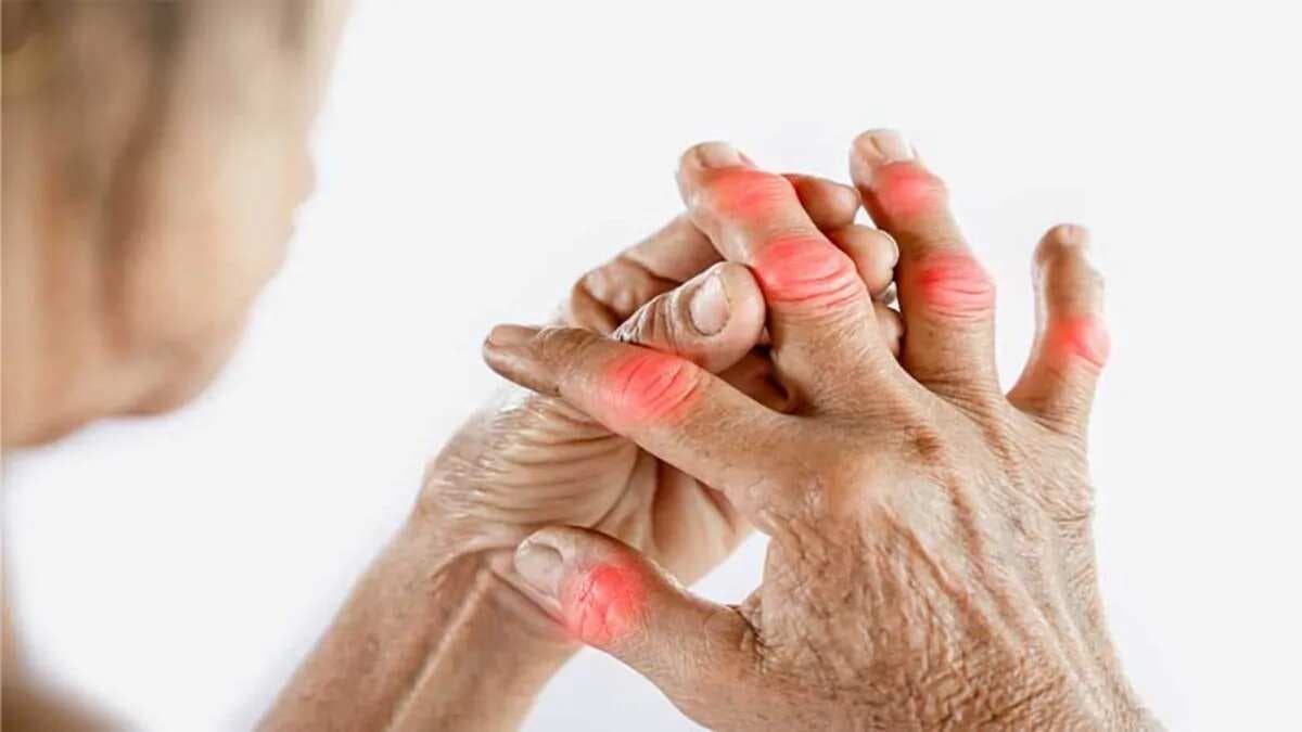 Relieve Arthritis Pain Naturally